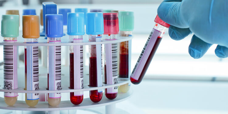 technician placing blood tubes in the laboratory centrifuge