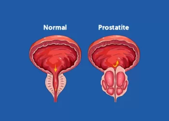 პროსტატიტი | ფოტო