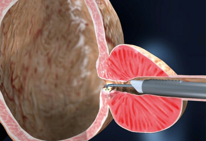 TURis Step1  application image 001 V1 20000101 700x480