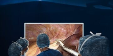 laparoscopy