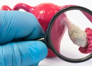 საკვერცხის კიბო, სიმსივნე | ფოტო