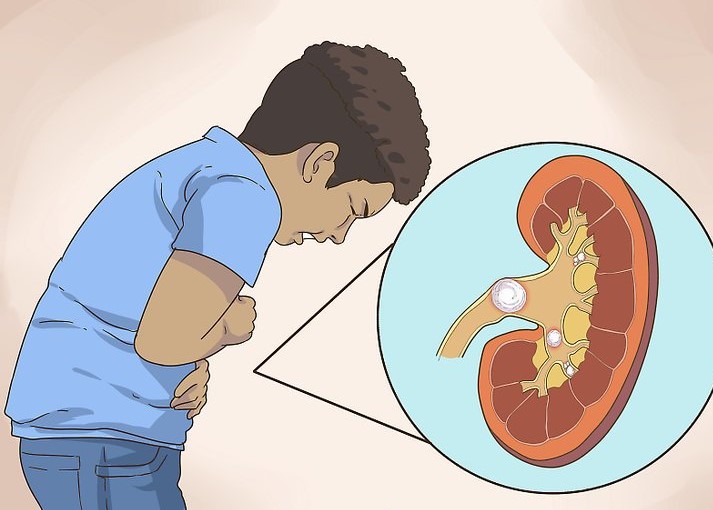 კენჭის გავლა