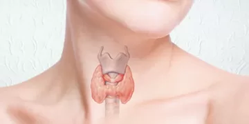 ფარისებრი ჯირკლის დაავადებები | ფოტო