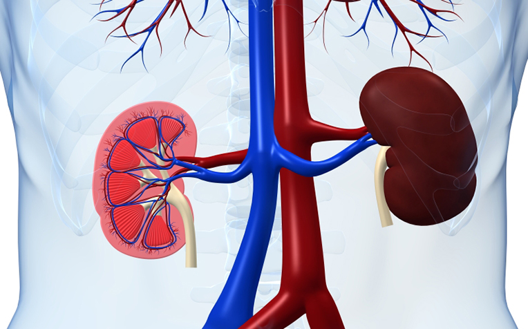 glomerulonephritis