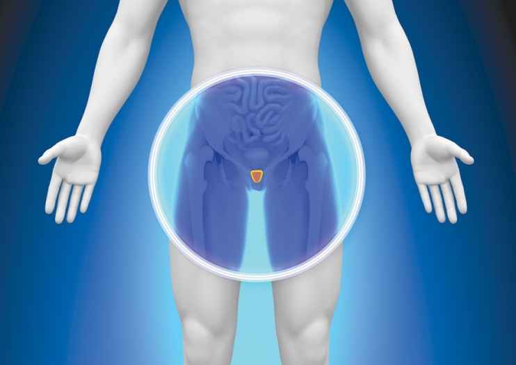 prostata 1