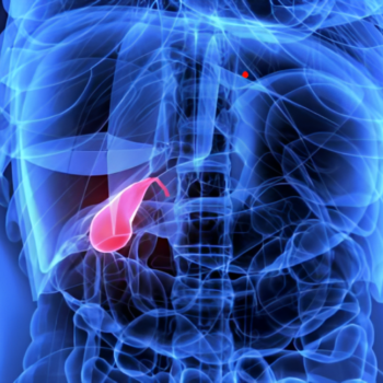 ნაღვლკენჭოვანი-დაავადებება-ნაღვლის-ბუშტის-კენჭები-მკურნალობა | ფოტო