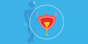 შარდის შეუკავებლობა კაცებში | ფოტო