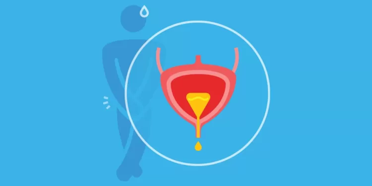 შარდის შეუკავებლობა კაცებში | ფოტო