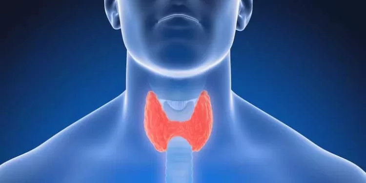 ჩიყვის სიმპტომები | ფოტო