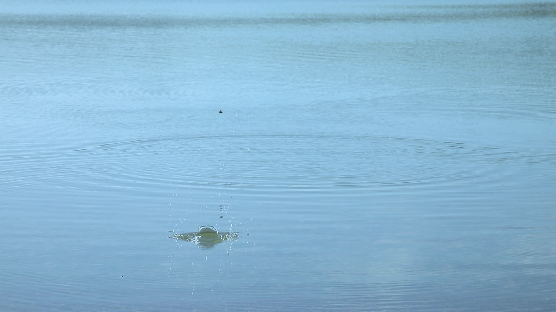 თირკმლის კენჭის სიმპტომები