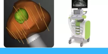 ბიოფსია | ფოტო