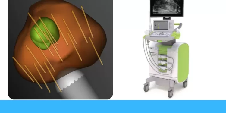 ბიოფსია | ფოტო