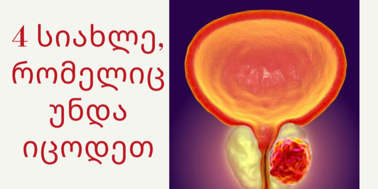 4 სიახლე