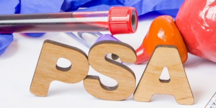 პსა-ს მაჩვენებელი