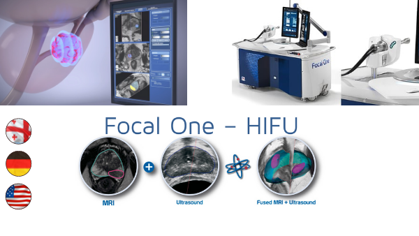 New Standard for Prostate Cancer Treatment – Focal One Implemented in ...