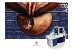 ფოკალური თერაპია