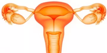 Ovarian cyst ─ Symptoms, diagnosis and treatment