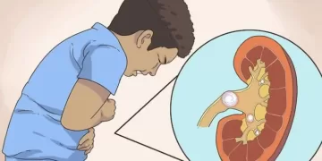 Выход камней | фото