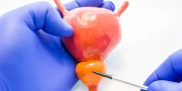 Простата - диsагностика | фото