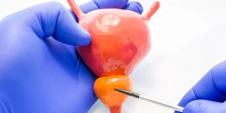 Простата - диsагностика | фото