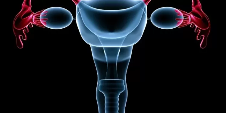 Что вызывает миому матки | фото