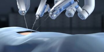 Robotic surgeries in urology, gynecology, and abdominal surgery