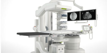 კენჭები სხეულში- კენჭის დაშლა ოპერაციის გარეშე