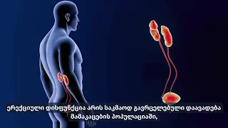 ერექციული დისფუნქციის მკურნალობა დარტყმით ტალღოვანი თერაპიით