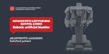 შარდის ბუშტის კიბოს მკურნალობა რობოტული ქირურგიით საქართველოში